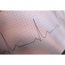ECG ROLL SMALL TO SUIT CT100/200