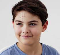 LEUKOPLAST STRIP NATURAL 12X100MM (72740-08) BX/300