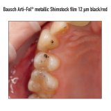 Arti Fol Metallic Complete 12&micro;m Black/Red Strips BK 328 20pk