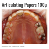 Bausch Articulating BK52 Red 100 microns 300 strips