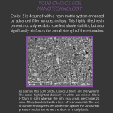 Choice 2 Starter Kit with ABU