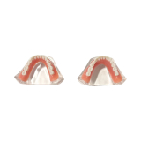 Locator Overdenture & Denture Model Set (2 Patient Models)