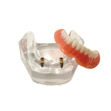 Locator Full Patient Model Kit (4 Patient Models)