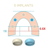 Locator Fixed Gold Starter Kit