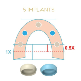 Locator Fixed Silver Starter Kit