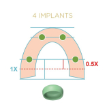 Locator Fixed Bronze Starter Kit