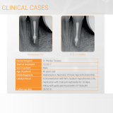 BIO C Sealer 2gm (4 x 0.5gm)